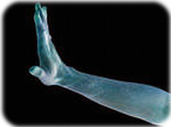 en loop Mij niet aan; want Ik zal u niet horen.